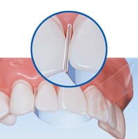 product-variant